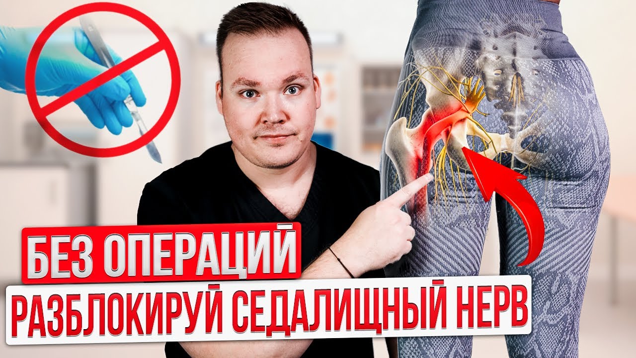 Защемило СЕДАЛИЩНЫЙ нерв. Делай СРОЧНО эти упражнения ДОМА. Боль уйдет за 5 минут