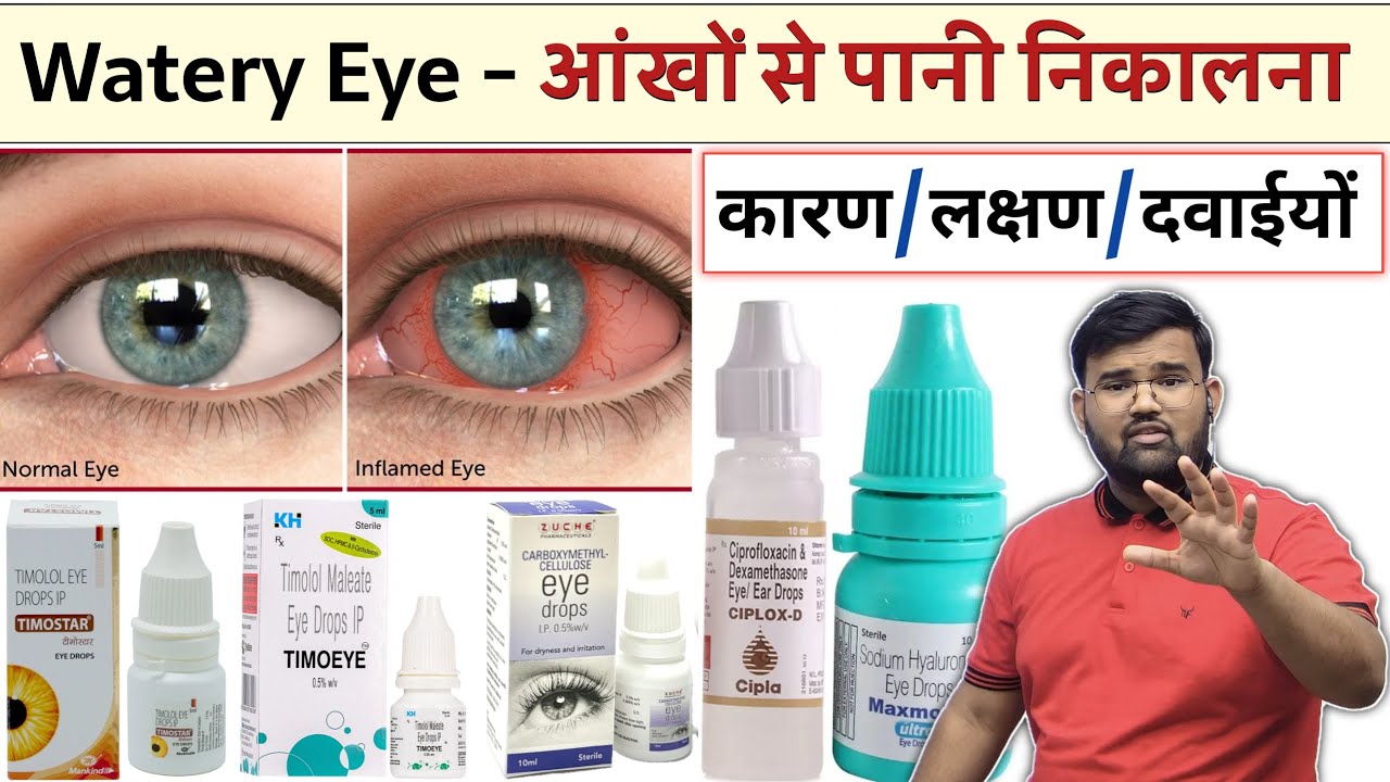 आंखों से पानी निकलना | Epiphora | Watery Eye | Eye Infection | Eye Drop | Treatment | Medicine