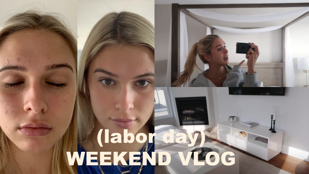 VLOG | my skin transformation.. apartment updates & more!