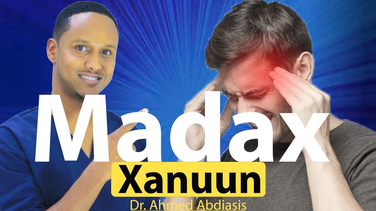 Maxaa keena madax xanuunka saa'idka ah?