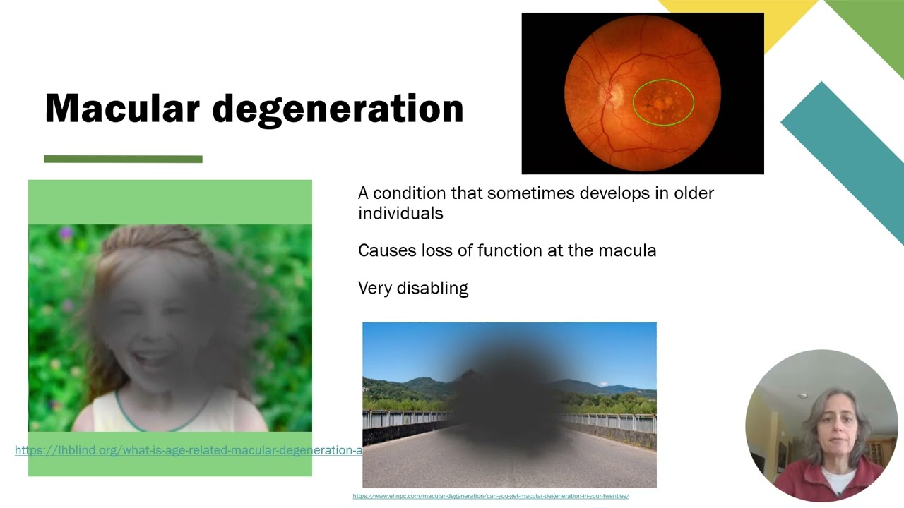 9c Vision Part 1   The Eye   Intro to Retina & Photoreceptors