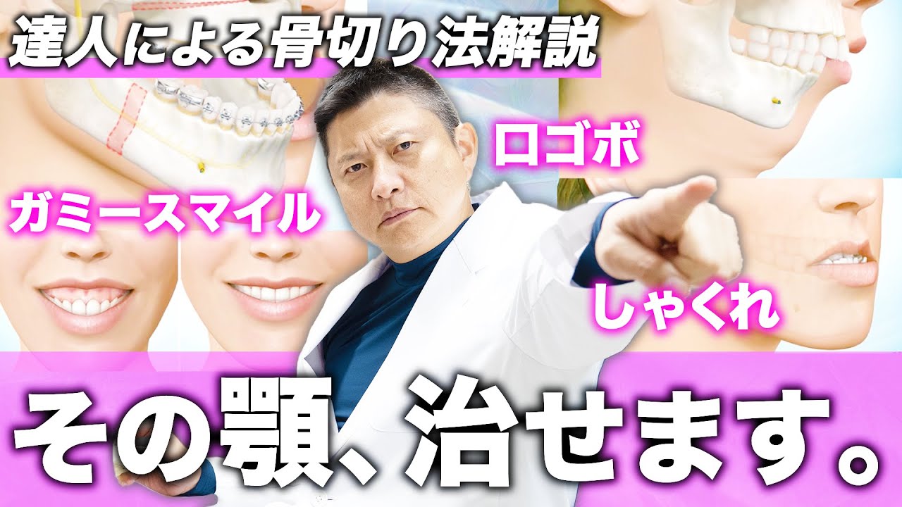 【しゃくれ・口ゴボ・ガミースマイル】どうやって治せばいいの？悩みタイプ別の手術法を徹底解説