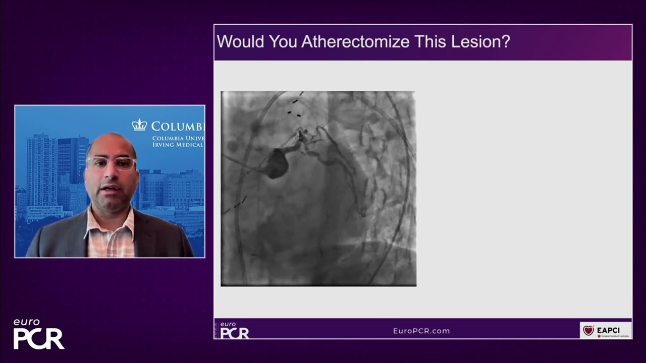 Incorporating coronary orbital atherectomy to my practice - EuroPCR 2022