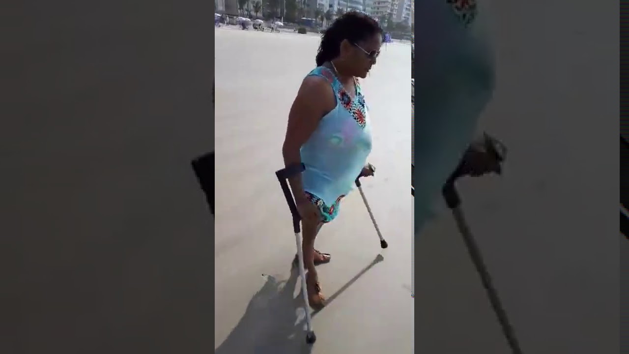 Polio woman at a beach removing her Brace and swimming