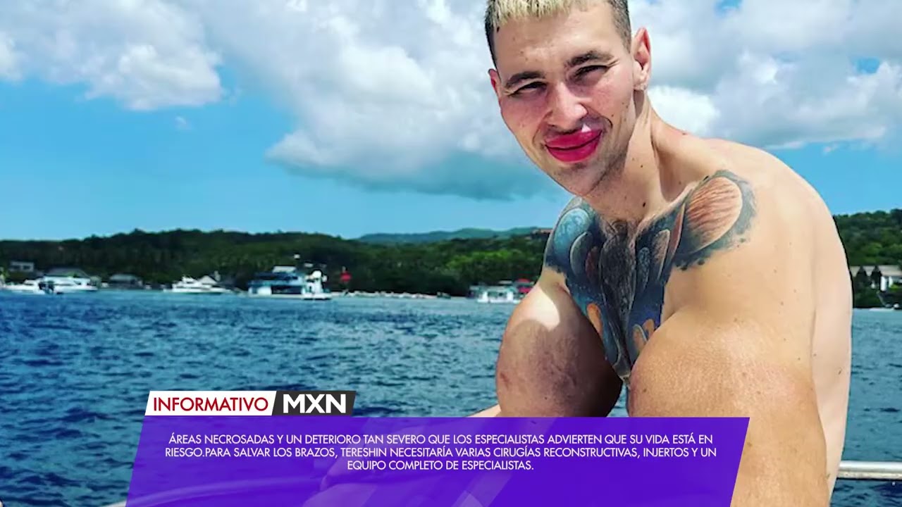 El “Popeye ruso” podría perder sus brazos tras inyectarse vaselina