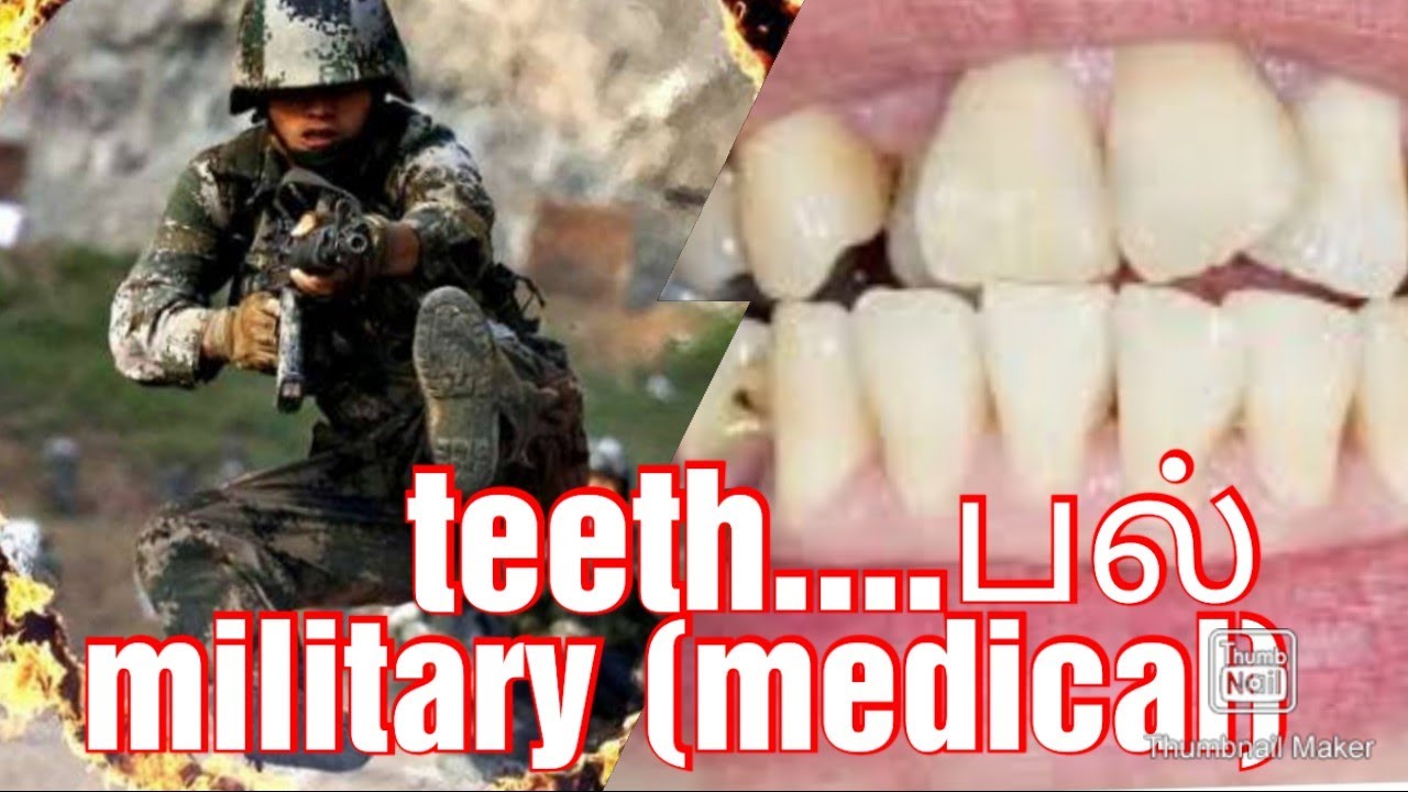 பல் பரிசோதனை... military teeth medical/lijin kanyakumari