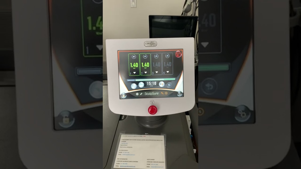 SculpSure Procedure