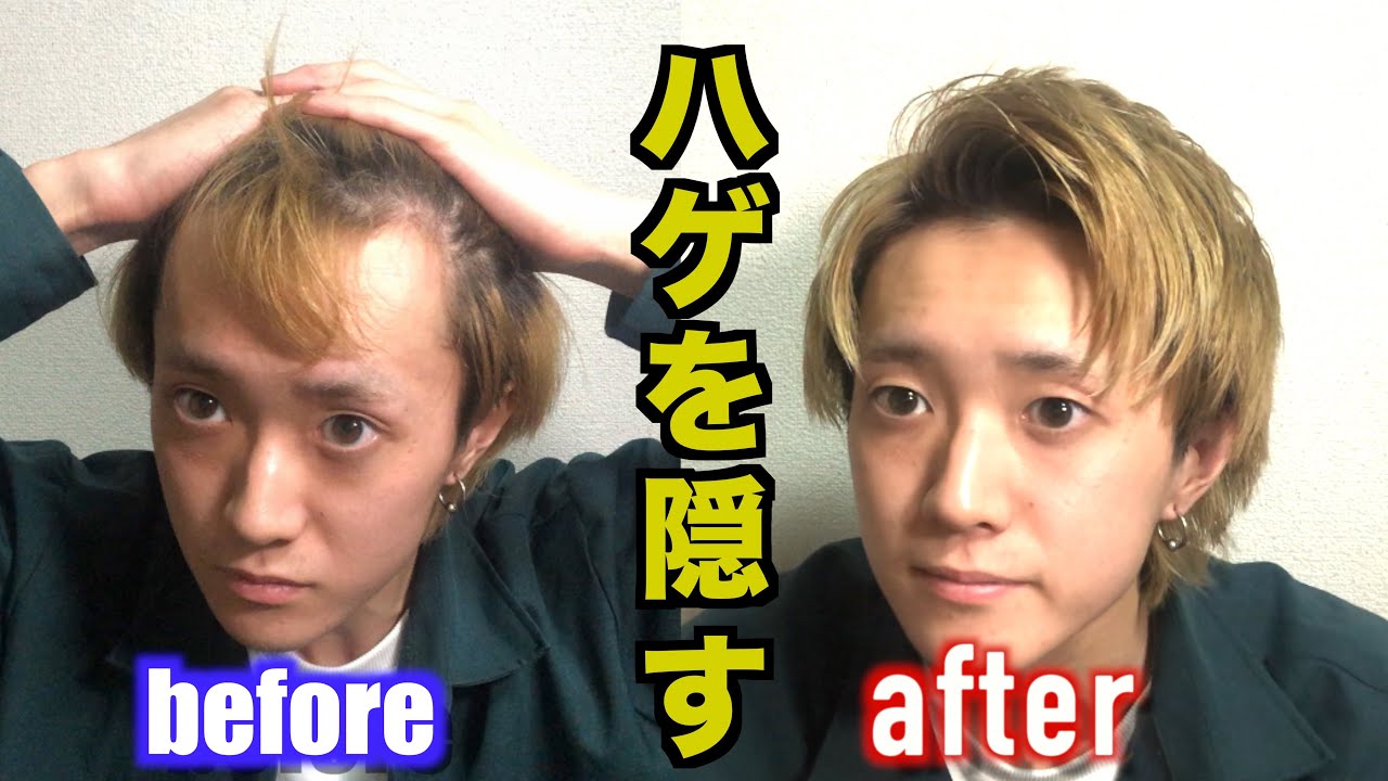 [朗報!!]ハゲを隠す驚異の髪セット術公開します!!