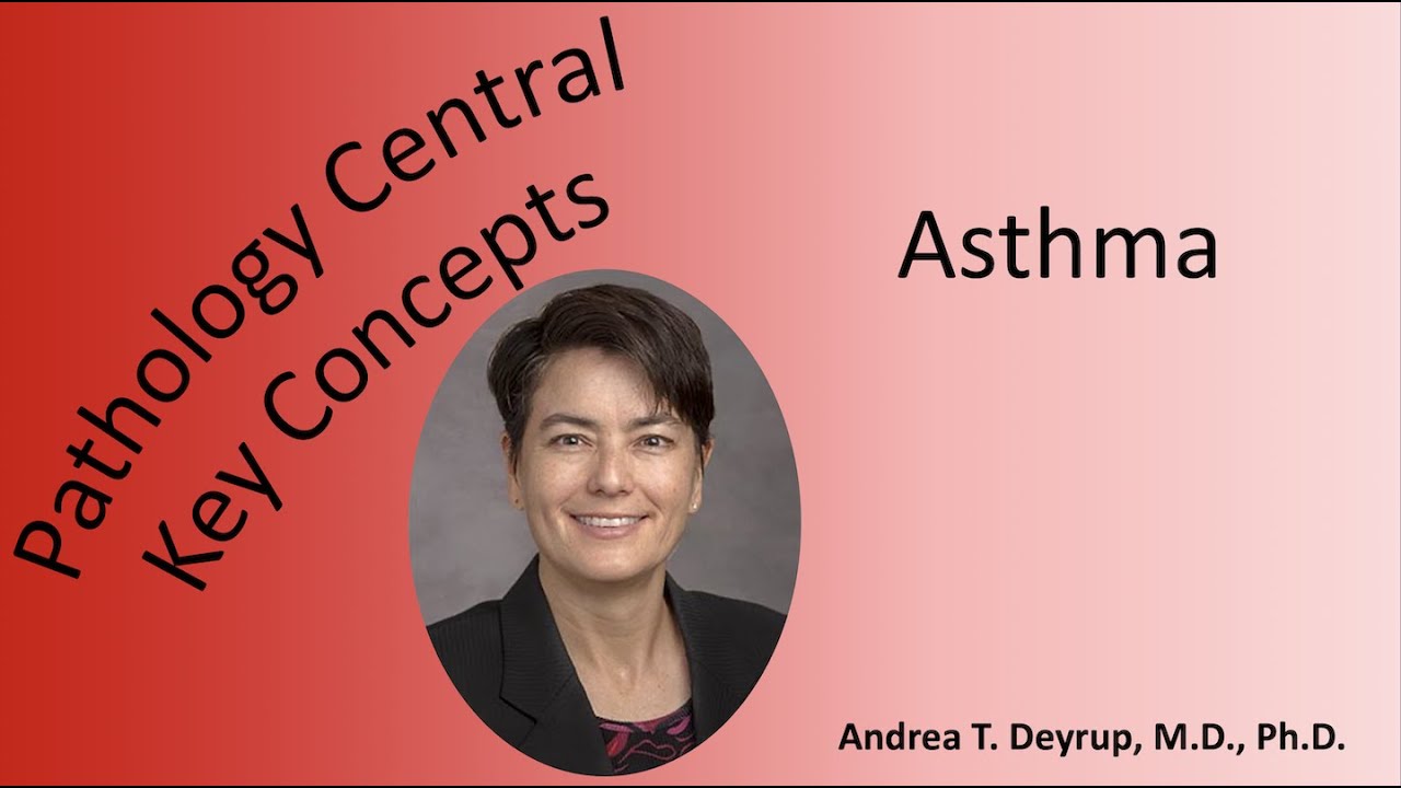 Medical School Pathology: Pathophysiology of Asthma