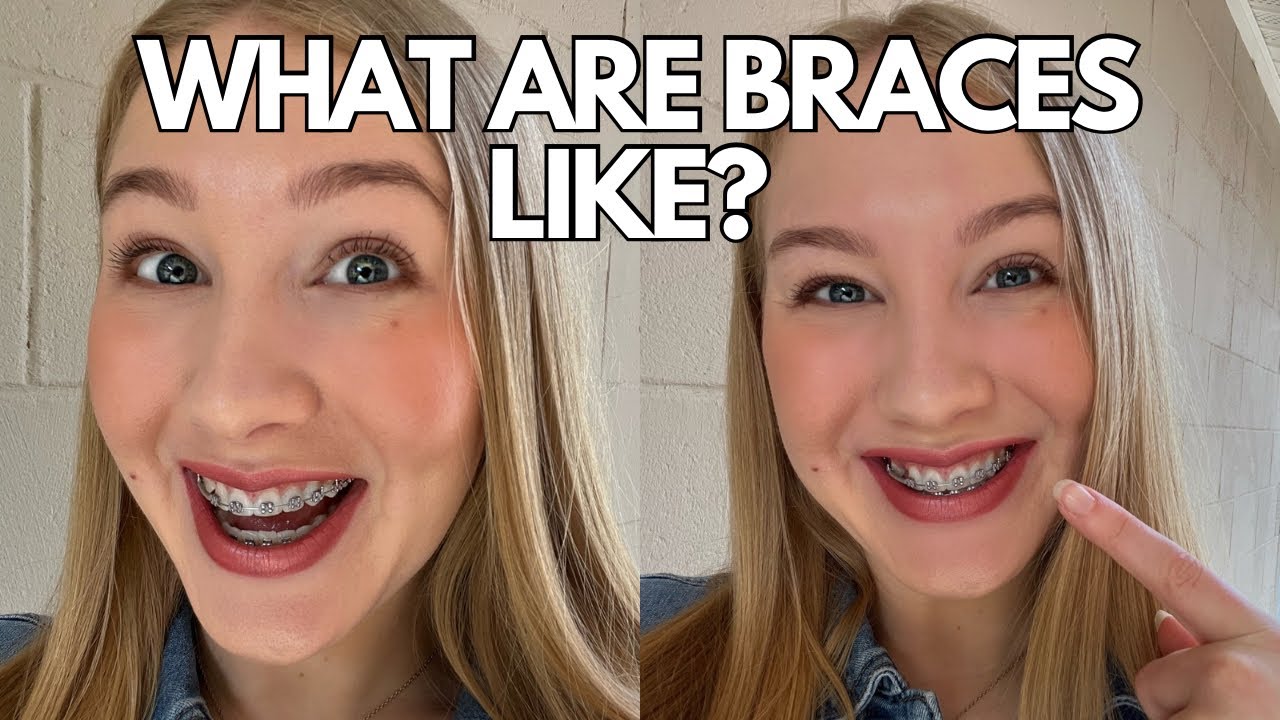The Truth About Braces