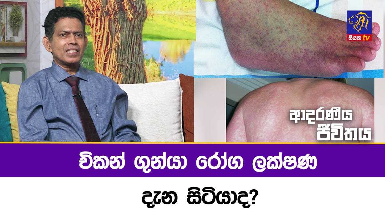 චිකන් ගුන්යා රෝග ලක්ෂණ දැන සිටියාද? | Adaraneeya Jeewithaya