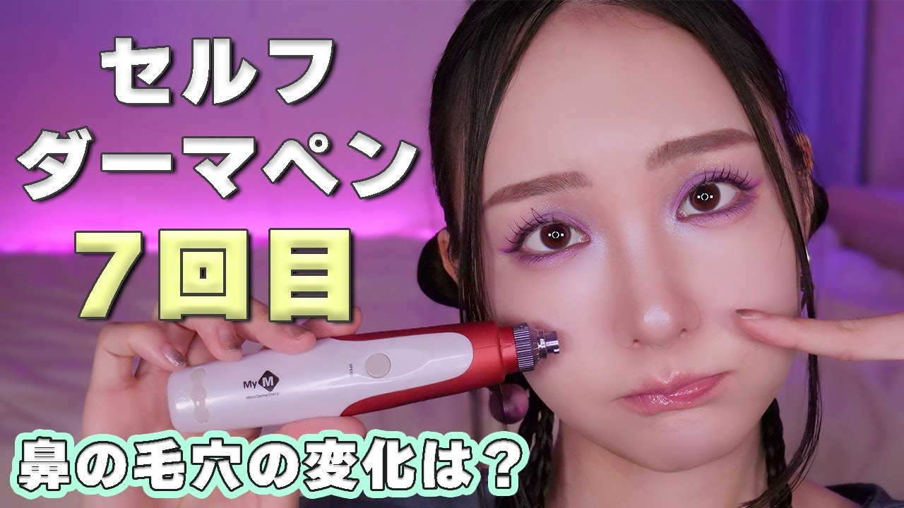 【セルフダーマペン】7回目👃鼻の毛穴の効果は？BeforeAfter約2週間高画質で35歳の肌比較◎【正直レビュー】