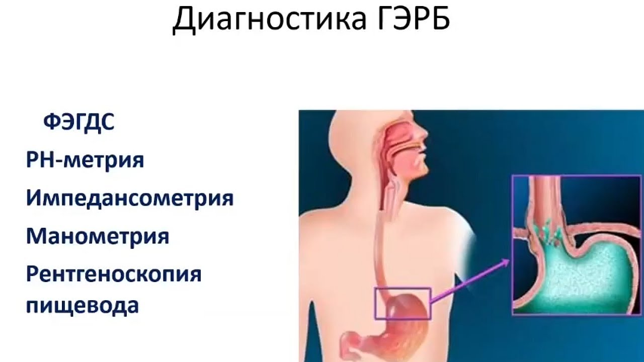 Лебедева А.В. Кислотозависимые заболевания желудочно-кишечного тракта