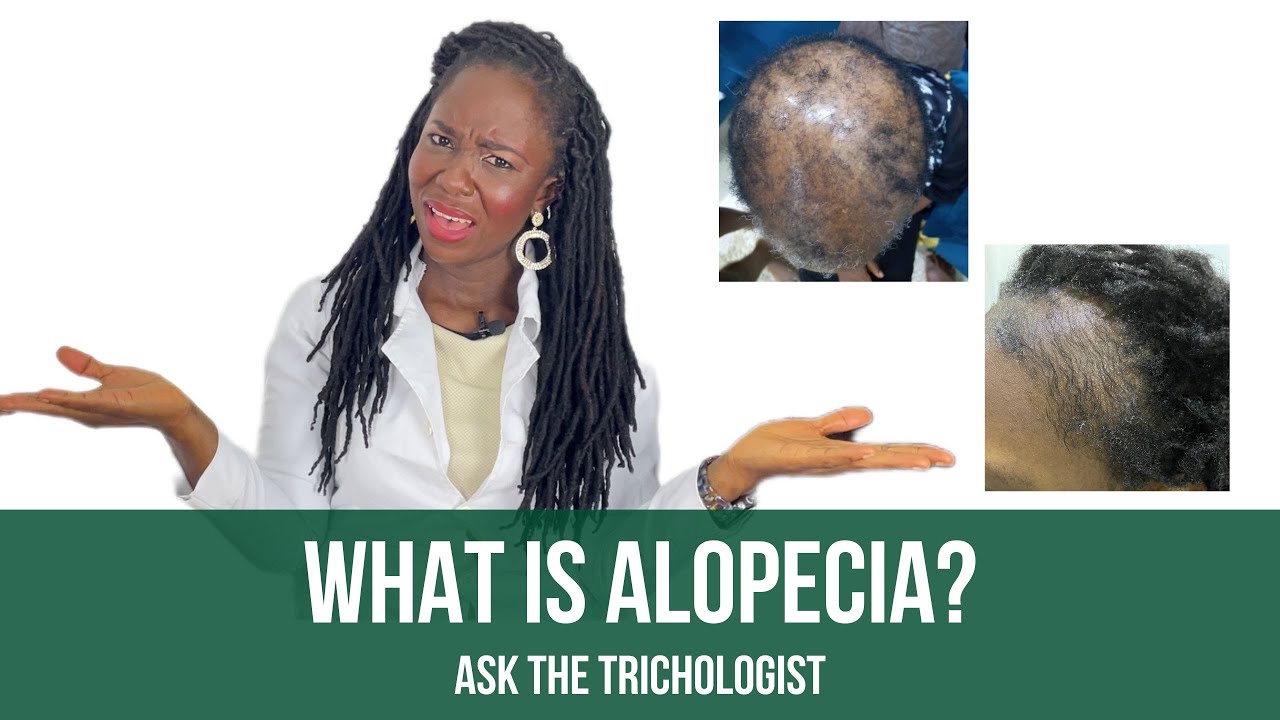 Hair Loss Explained: Causes, Signs & Treatment | Ask The Trichologist Ep.18 #hairloss #alopecia