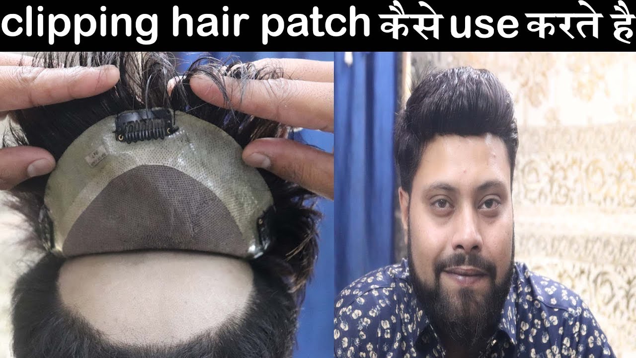 How to setup | clipping in hair patch | by delhi hair fixing. Abdul Rahman whats aap no – 9873152223