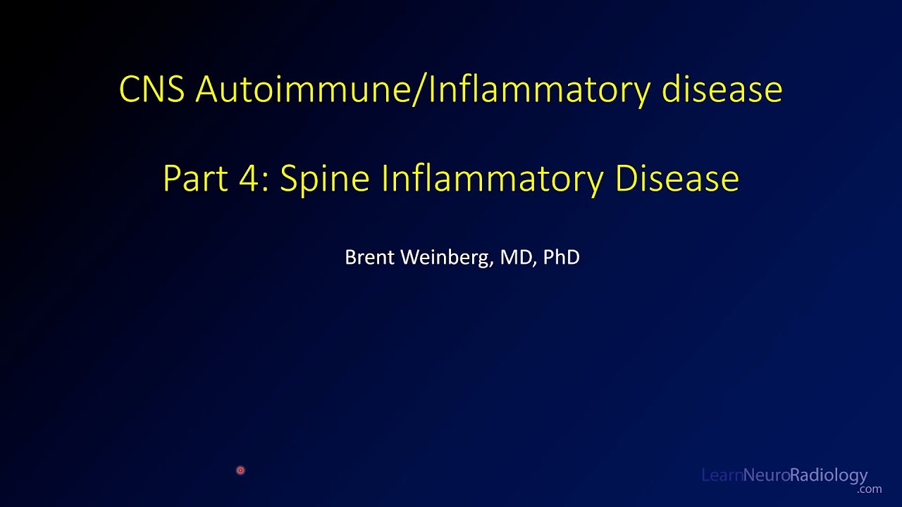 Imaging CNS autoimmune and inflammatory disease - 4 - Spine inflammatory disease