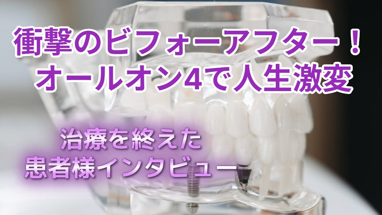 【オールオン４】治療を終えた患者様インタビュー