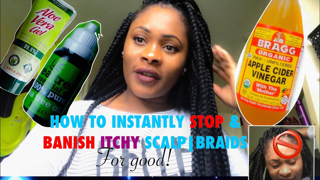How to instantly stop and banish itchy scalp/braids for good❗️