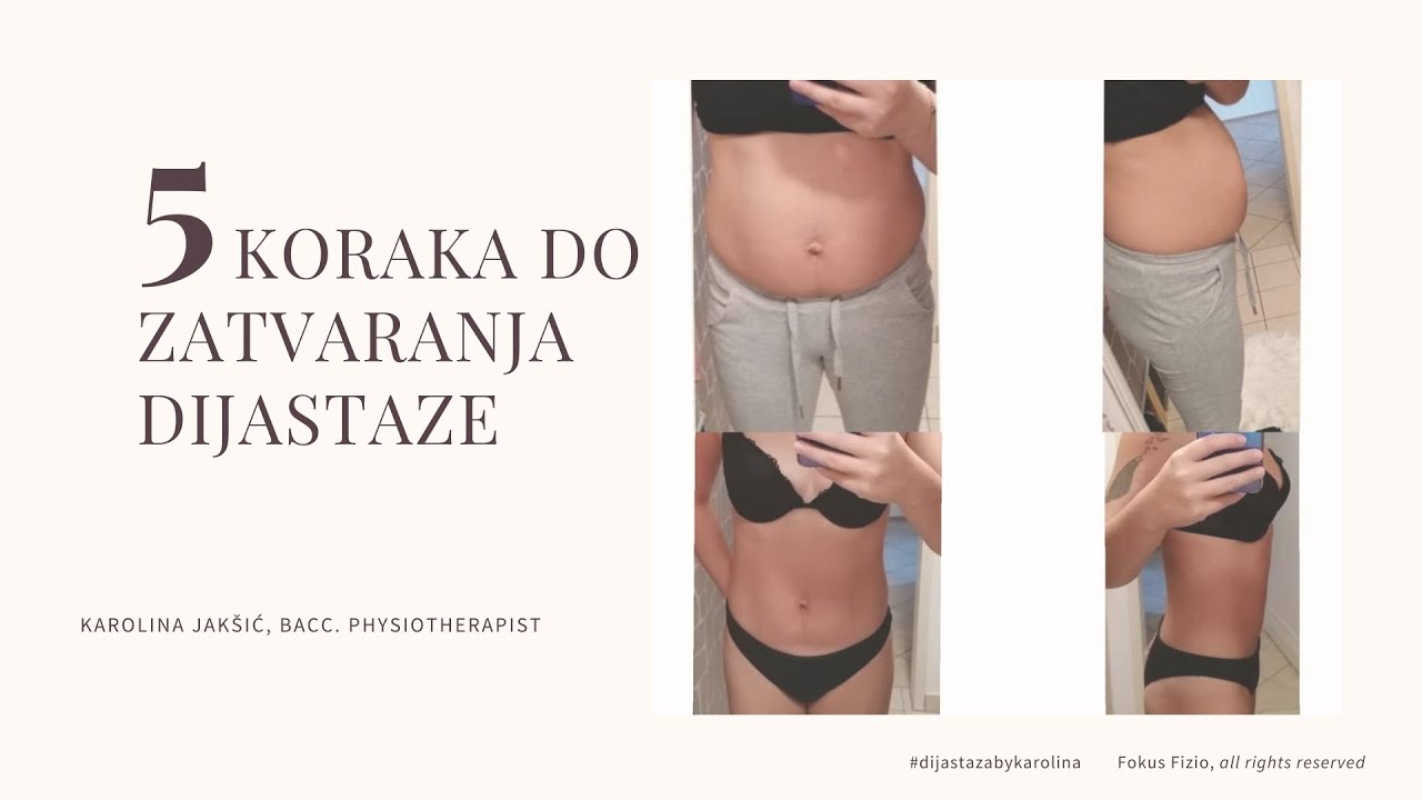 5 koraka do zatvaranja dijastaze I Webinar Zoom I Dijastaza I Karolina Jakšić