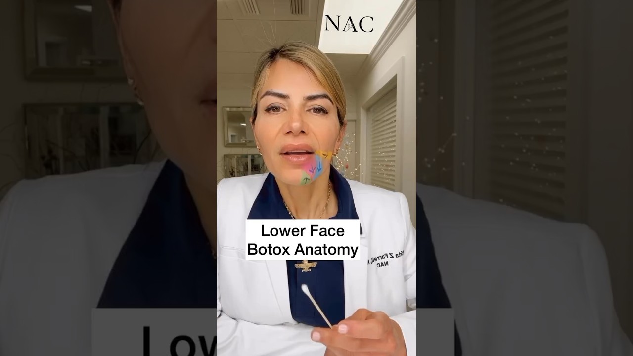 Анатомия нижней части лица после ботокса #drbitafarrell #botox #красота