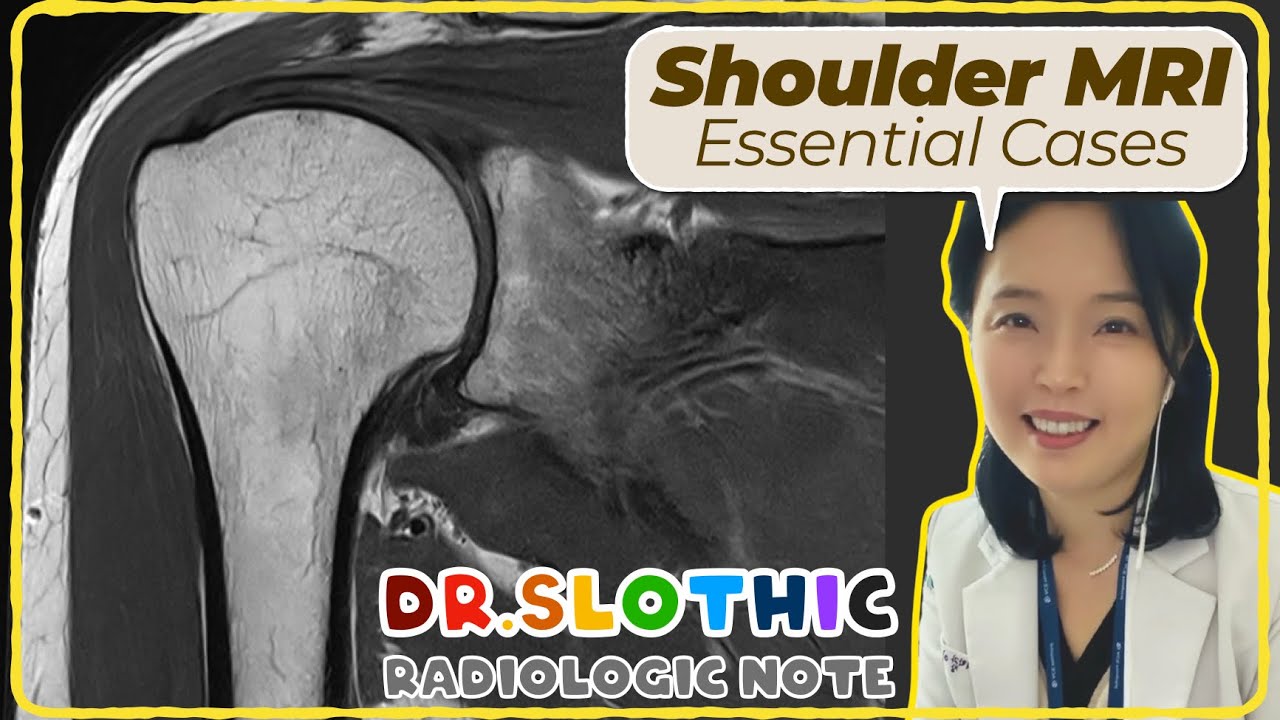 Shoulder MRI Masterclass: Core Cases Every Radiologist Should Know