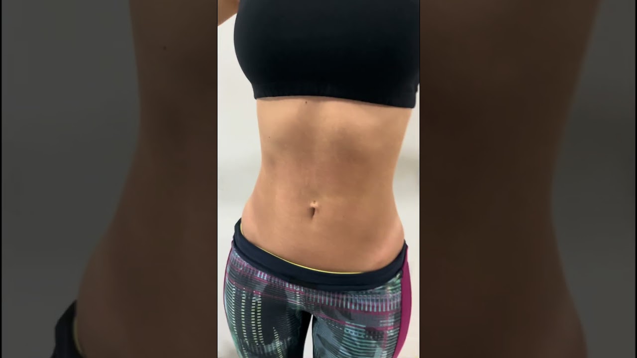 Antes e Depois (4 meses) do Morpheus 8 - Dra. Virgínia Humphreys
