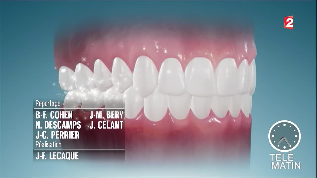 Santé - Le fil dentaire : pour ou contre ?