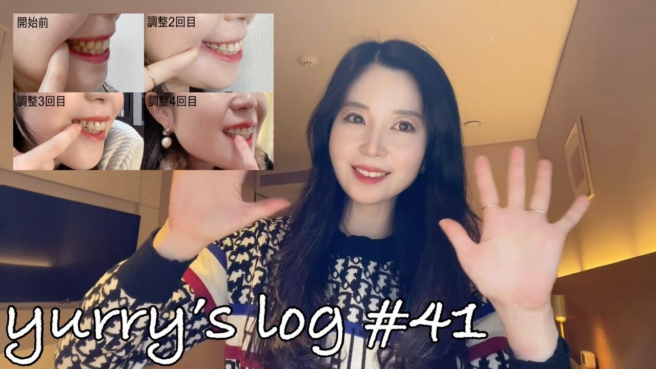 41. [VLOG] 祝！2回目のブラオフをしました！/再歯列矯正/ワイヤーのリテーナーをつけたお話/マウスピース/口ゴボ/Eライン/社会人の休日/些細な日常