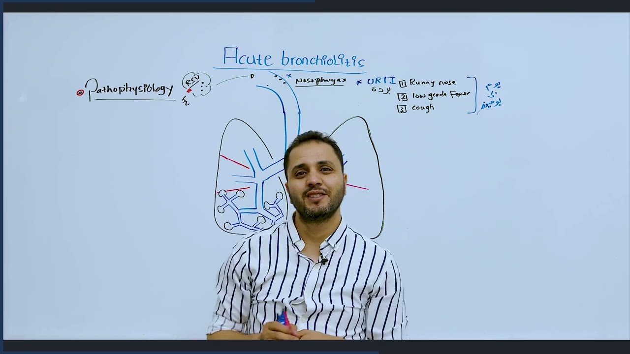 Acute bronchiolitis - د.عبد الرحمن الجعكي