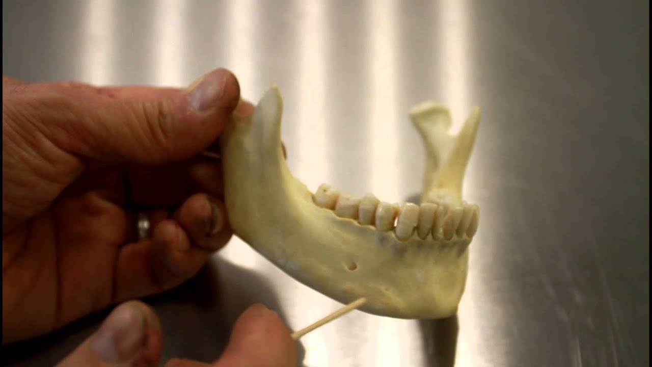 SKELETAL SYSTEM ANATOMY: Mandible