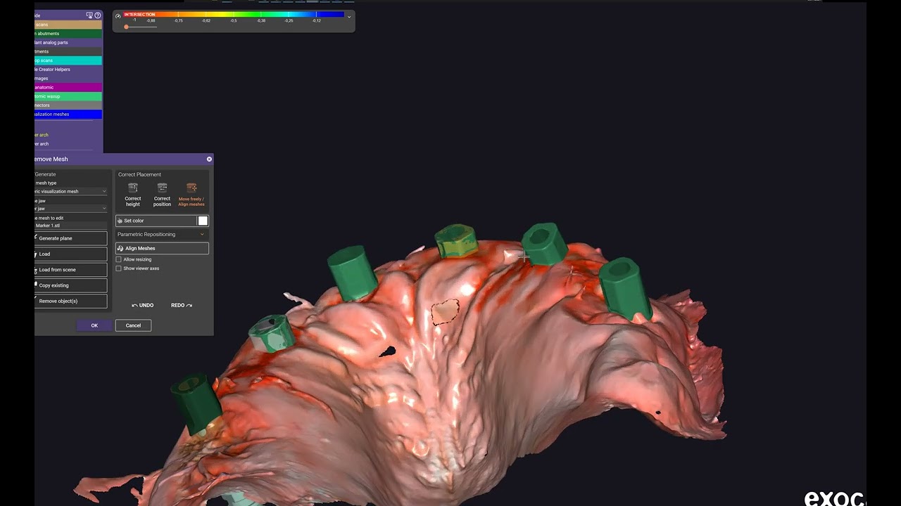 How to Fix scan marker to fit well - exocad