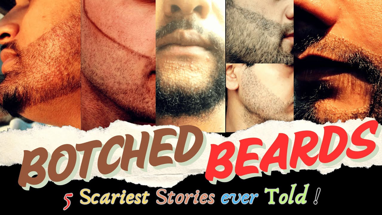 Beard Hair Transplant in India | UPDATE