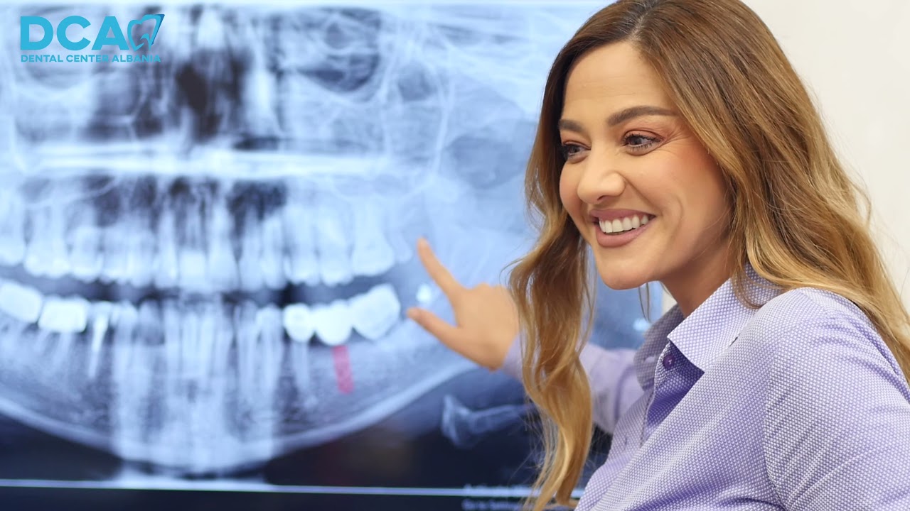 #bietasulo #dental #clinic #albania #tirana #dca 🇦🇱