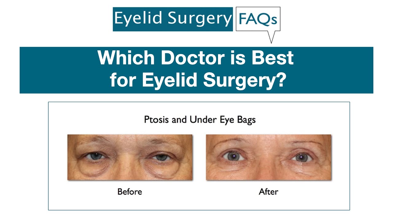 Which Doctor is Best for Eyelid Surgery?