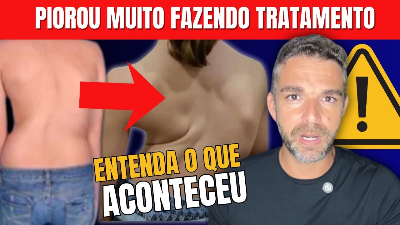 O QUE PIORA A ESCOLIOSE - EVITE ESSAS 5 COISAS 