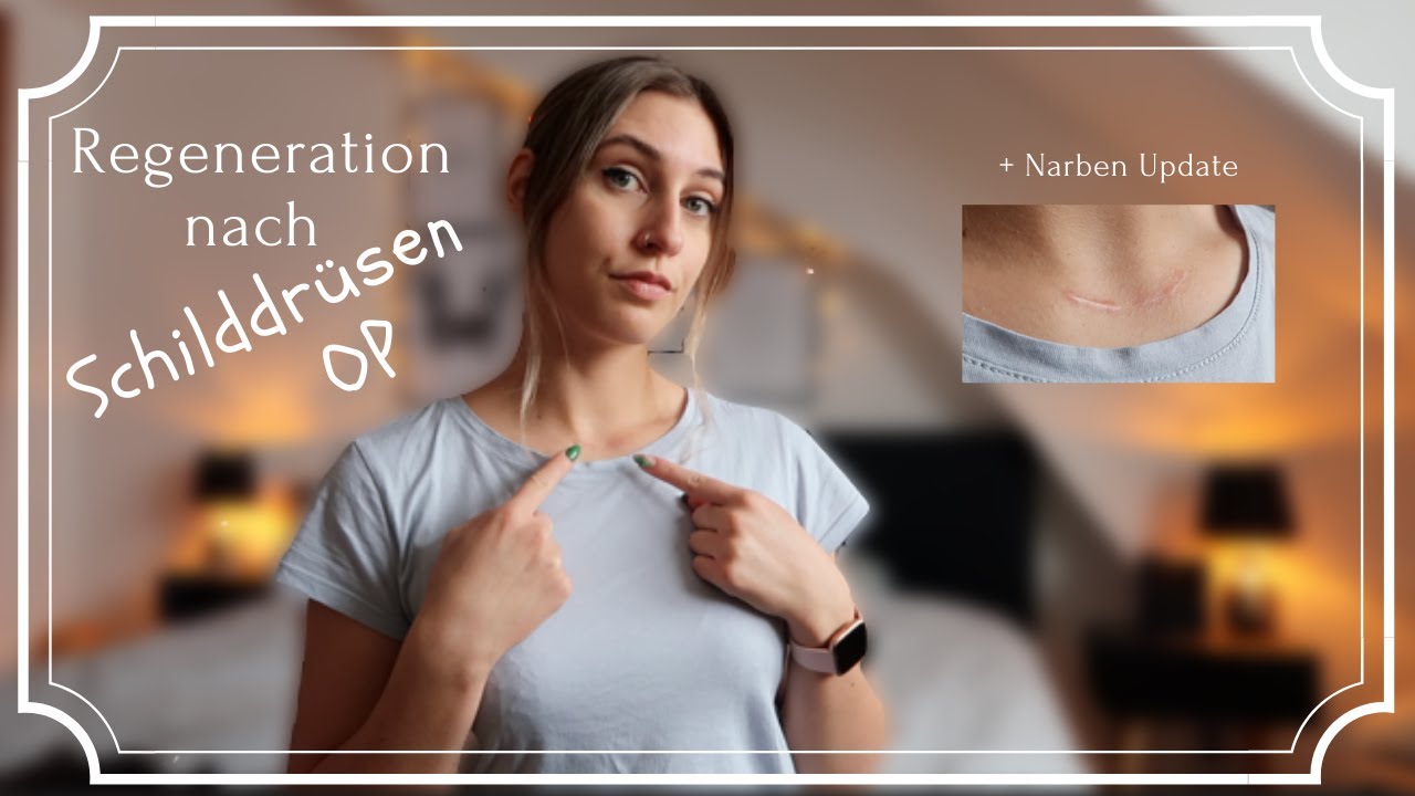 Update nach Schilddrüsen OP ⎢Regeneration ⎢OP Narbe ⎢Tipps nach der OP ⎢Erfahrungsbericht 🏥