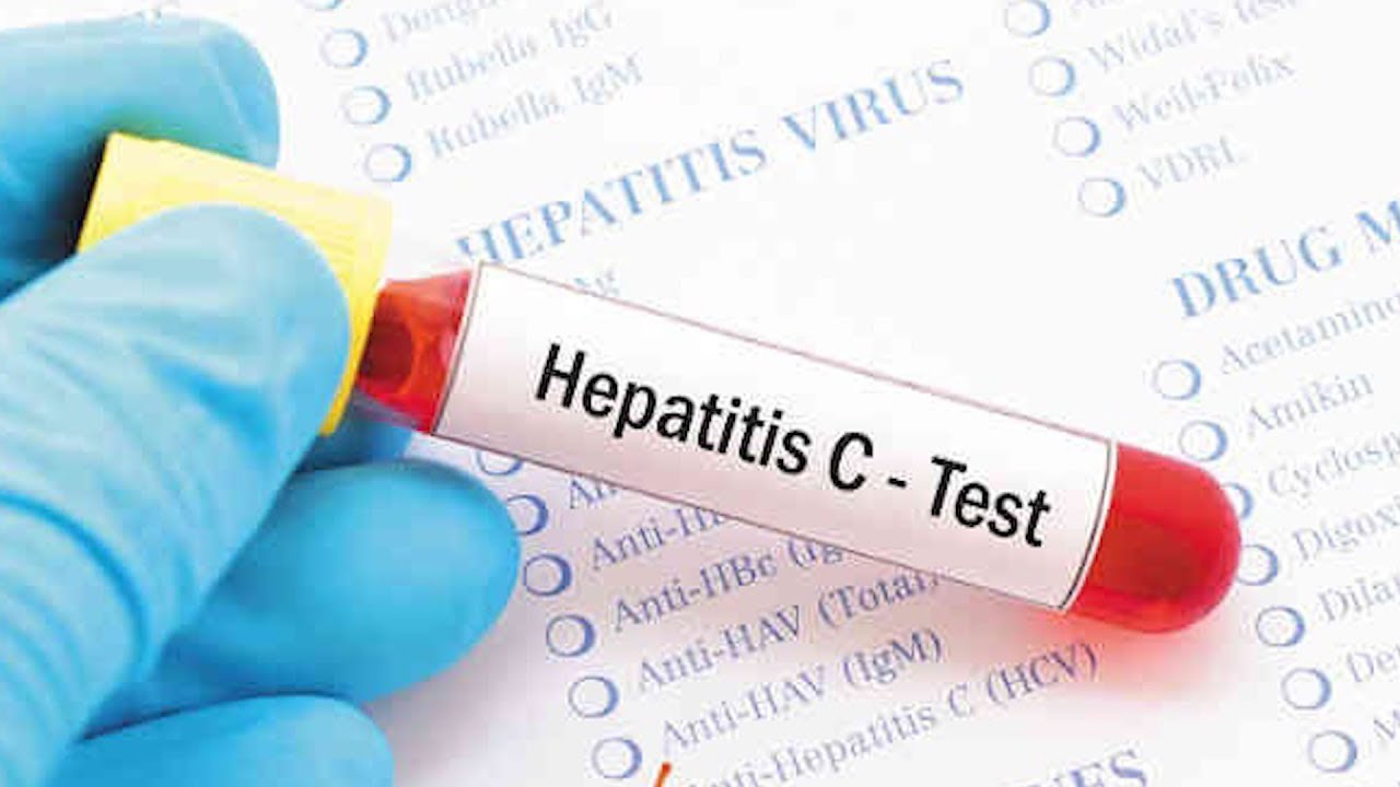 Hepatitə yoluxmamaq üçün nələrə diqqət etməliyik? - HƏKİM MƏSLƏHƏTİ