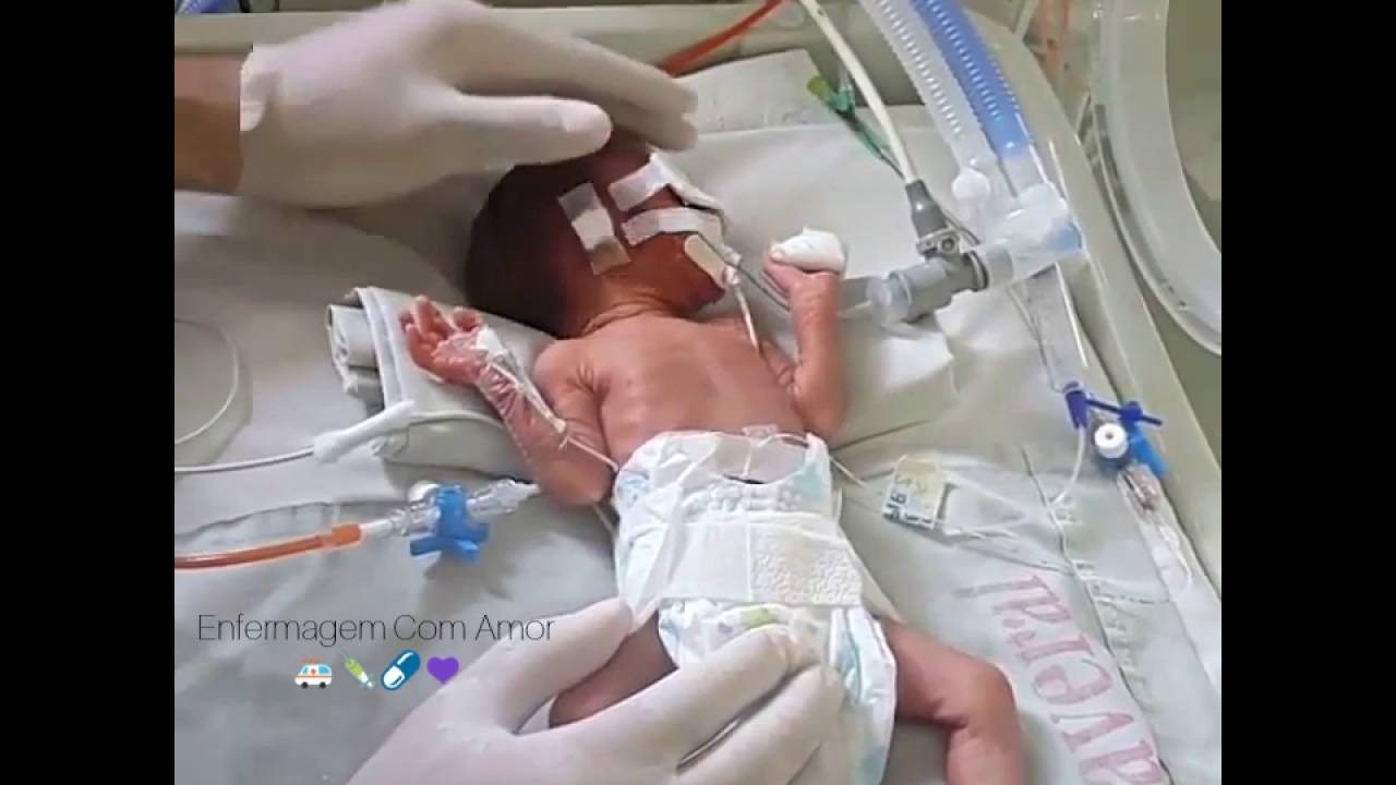 Beb&ecirc; Prematuro