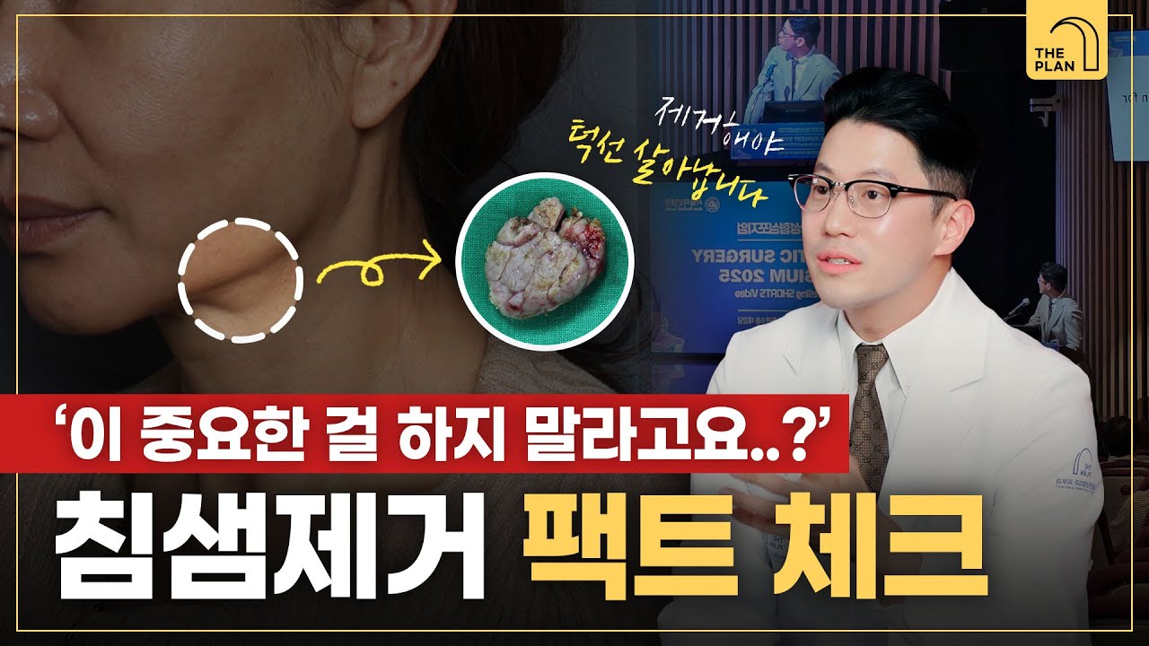 안면거상 시 침샘제거 회피하는 병원?🚫&rsquo;이것&rsquo; 하나만 체크하세요 | 턱선 고민인 사람 주목