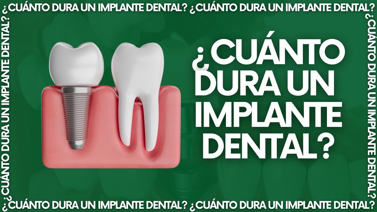 ¿Cuánto dura un Implante Dental? 5 Claves para Mantenerlo de Por Vida