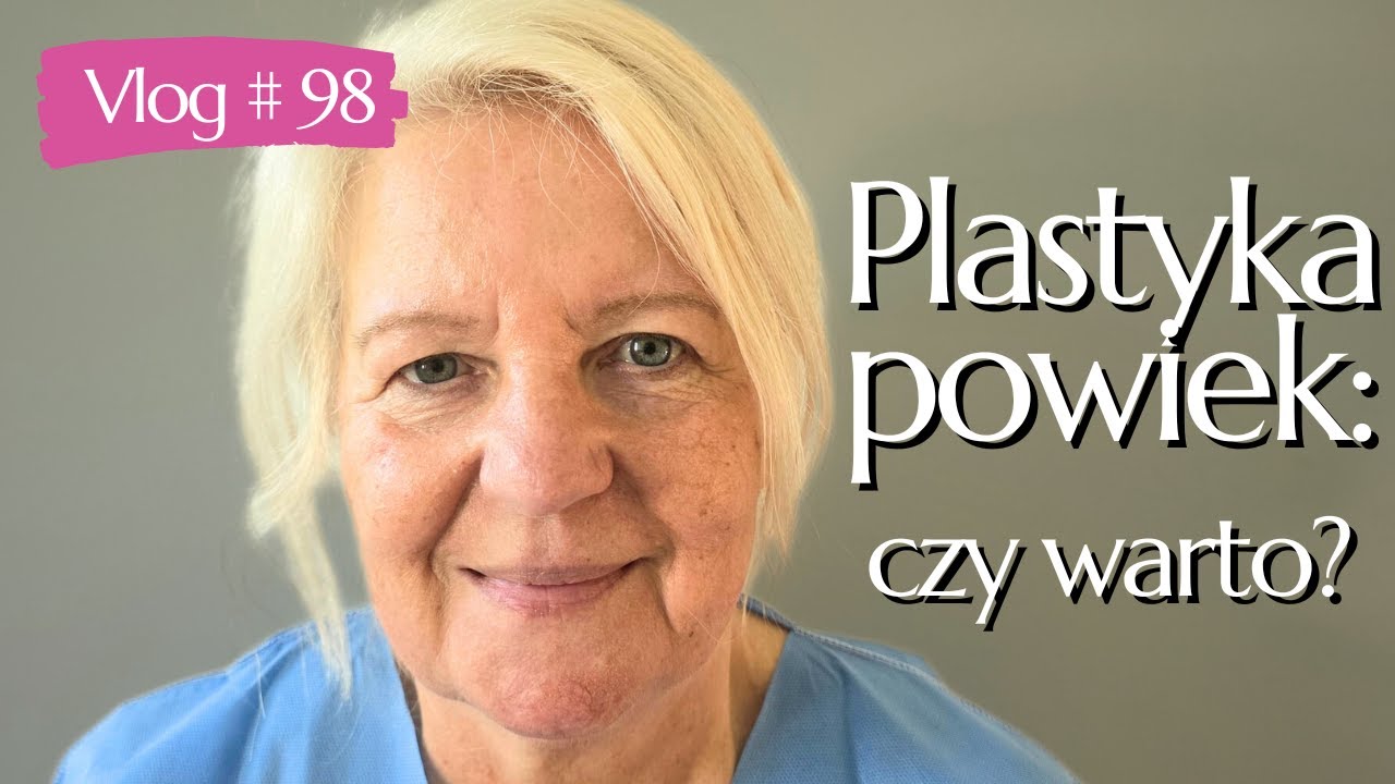 #98 PLASTYKA POWIEK GÓRNYCH: PRZED I PO, moja opinia, efekty i czy warto?👁️✨| BLEFAROPLASTYKA