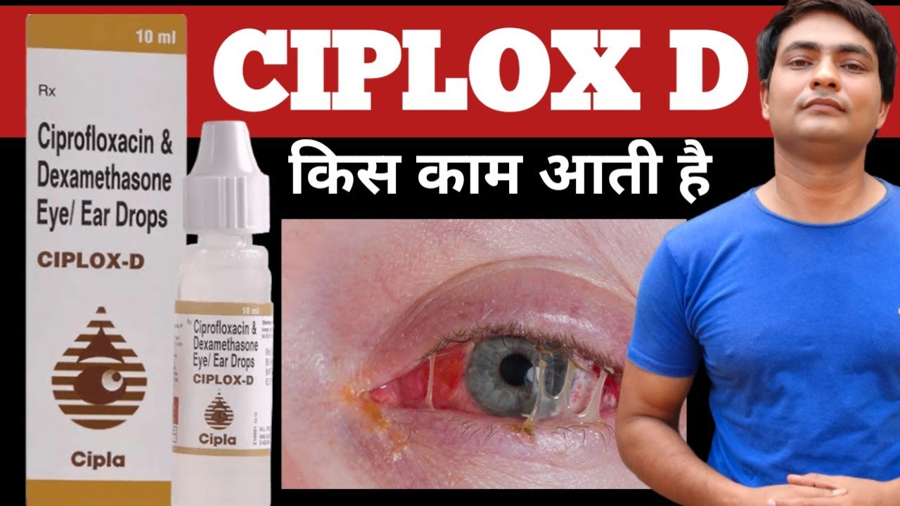 ciplox d eye ear drops | ciplox d eye ear drops uses in hindi | ciplox d ear drops