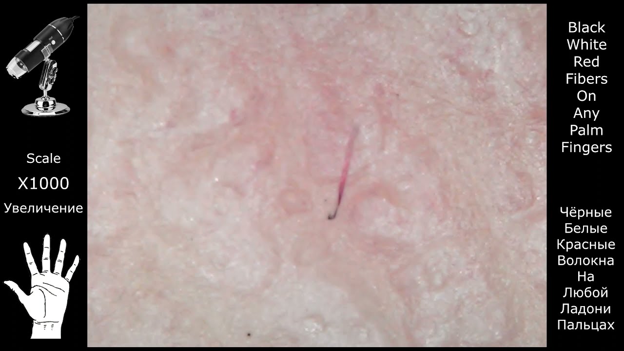 Black, white and red fibers on any palm and fingers | Чёрные, белые, красные волокна на руках