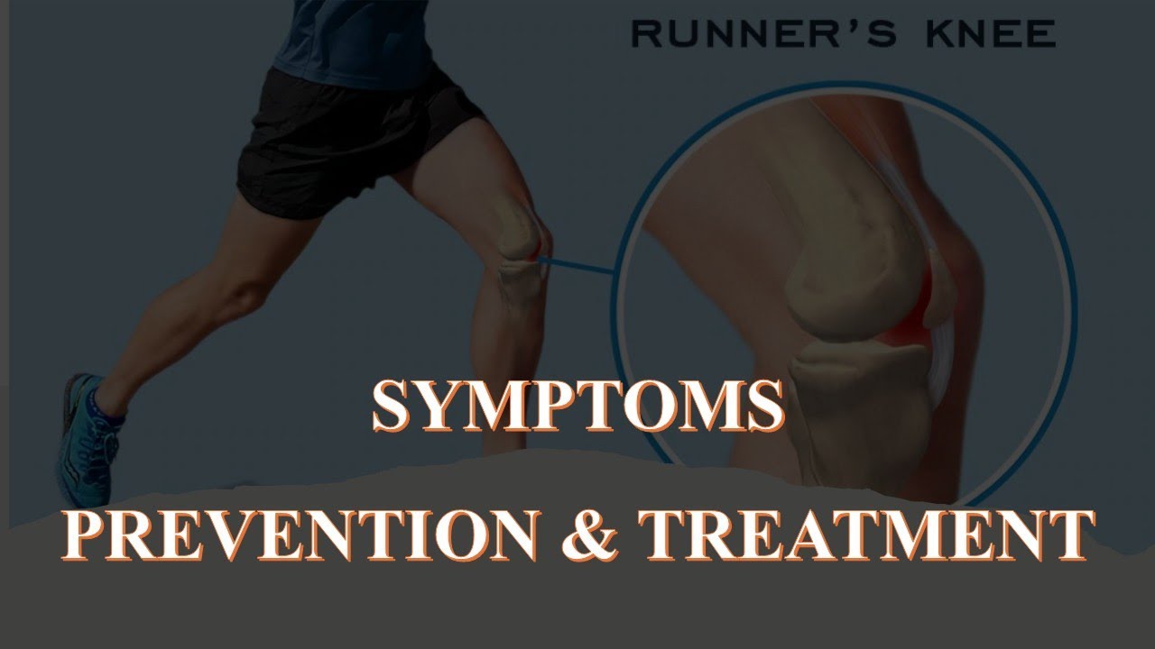 Understanding Patellofemoral Pain Syndrome (Runner's Knee): Causes, Symptoms & Fixes