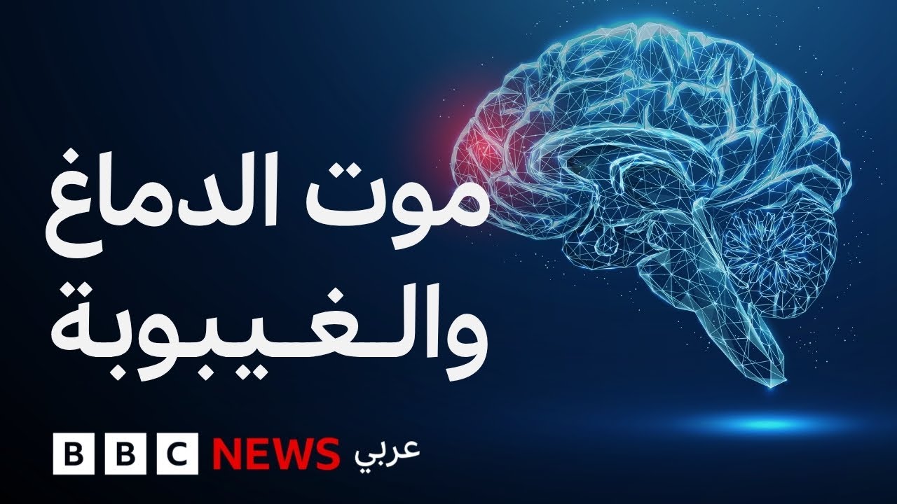 ما الفرق بين الغيبوبة والموت الدماغي؟