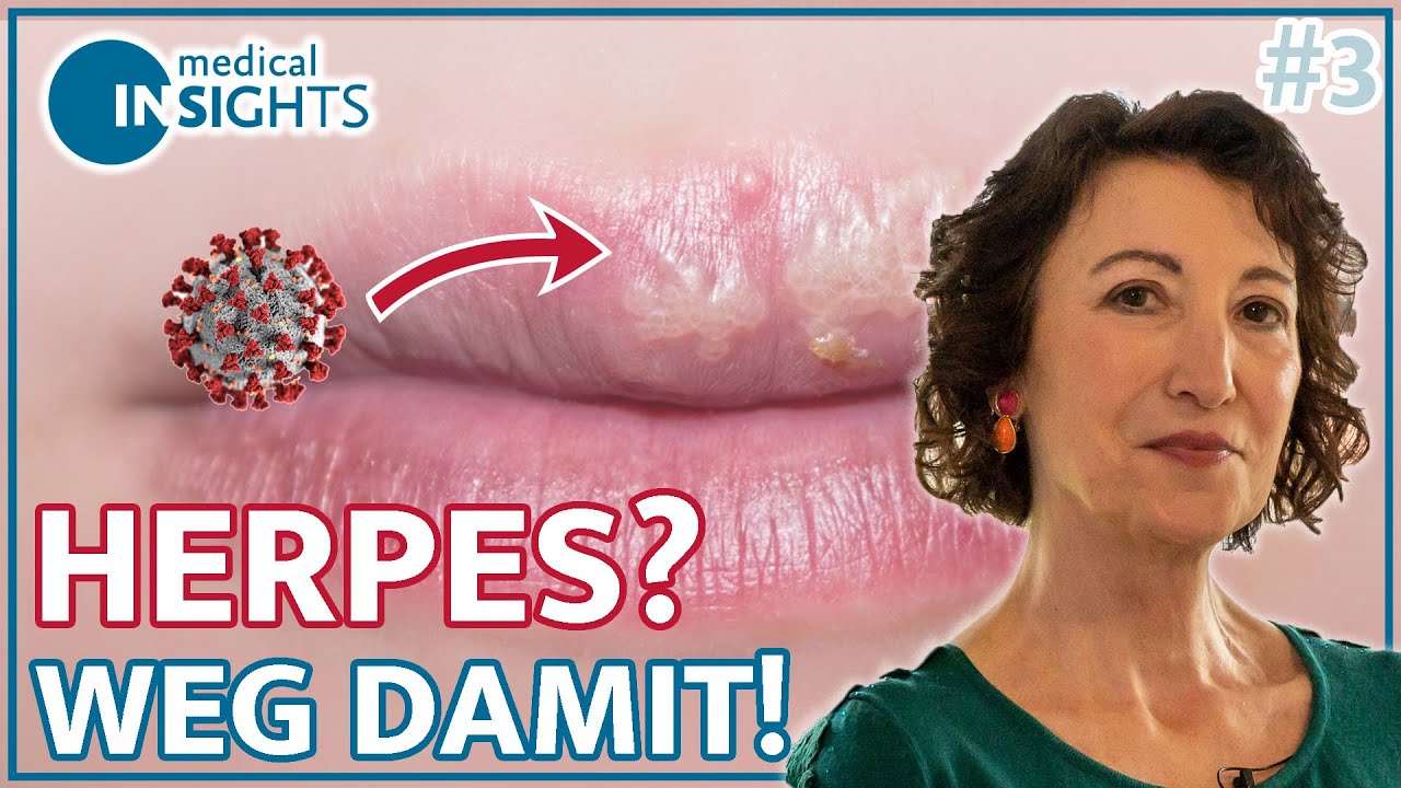 So wird Herpes getriggert! | medical INSIGHTS