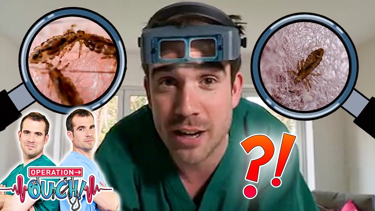 Piojos, liendres y chinches | Operation Ouch en Español