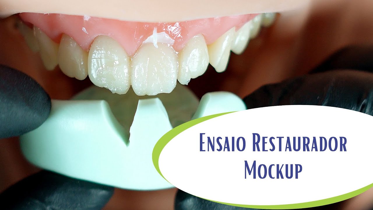 Passo a passo para realizar um ensaio restaurador (Mockup).