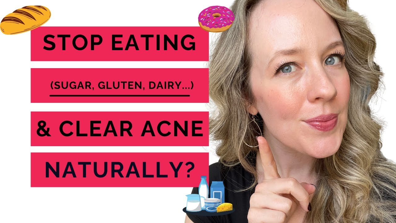 Acne diet guide - WHAT TO CUT OUT TO HEAL YOUR ACNE NATURALLY.