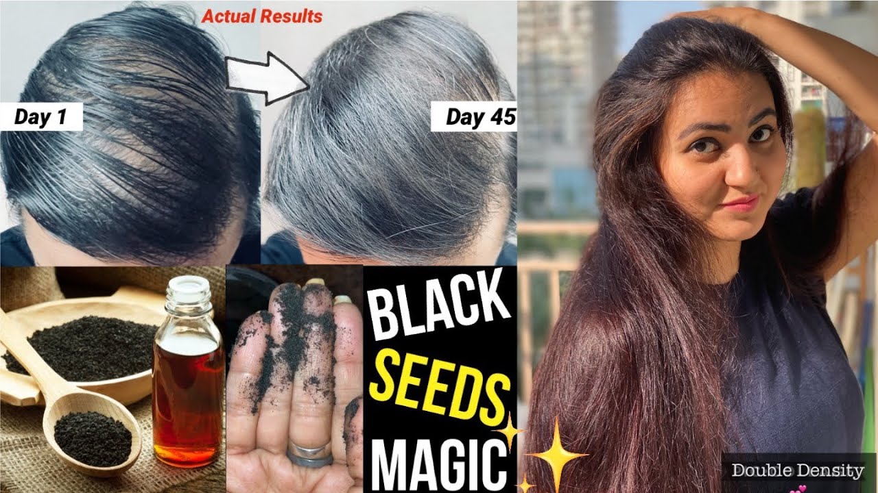 Black Seeds की ये रेमेडी से Thin Hair होंगे Thick 💕| गंजेपन Baldness सफ़ेद बालों का करें अचूक उपचार